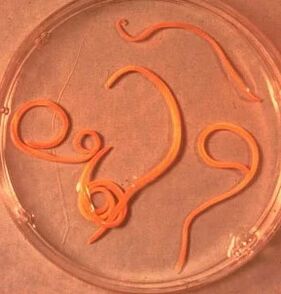 Паразити на мъжа Аскарид