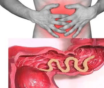 Човешки паразити