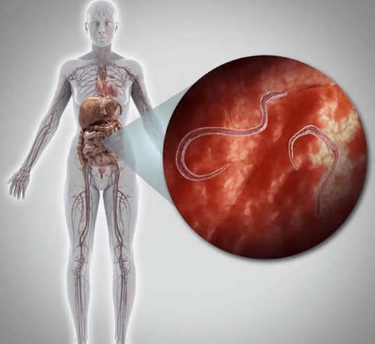 Паразити в човешкото тяло
