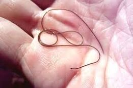 Паразит в дланта на ръката ви