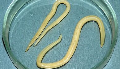 Как да се вземат правилно тестове за аскариаза