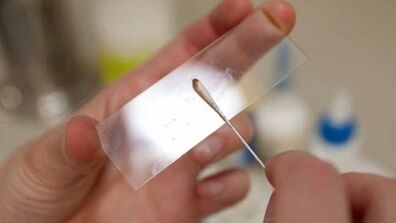 Кале анализ за идентифициране на паразити