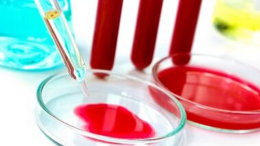 Кръвен тест за паразити