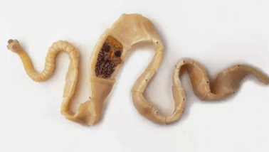 Как да открием наличието на паразити в тялото