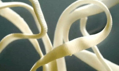 Как да премахнете паразити от човешкото тяло